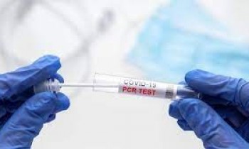 PCR testi zorunluluğu kalktı mı?